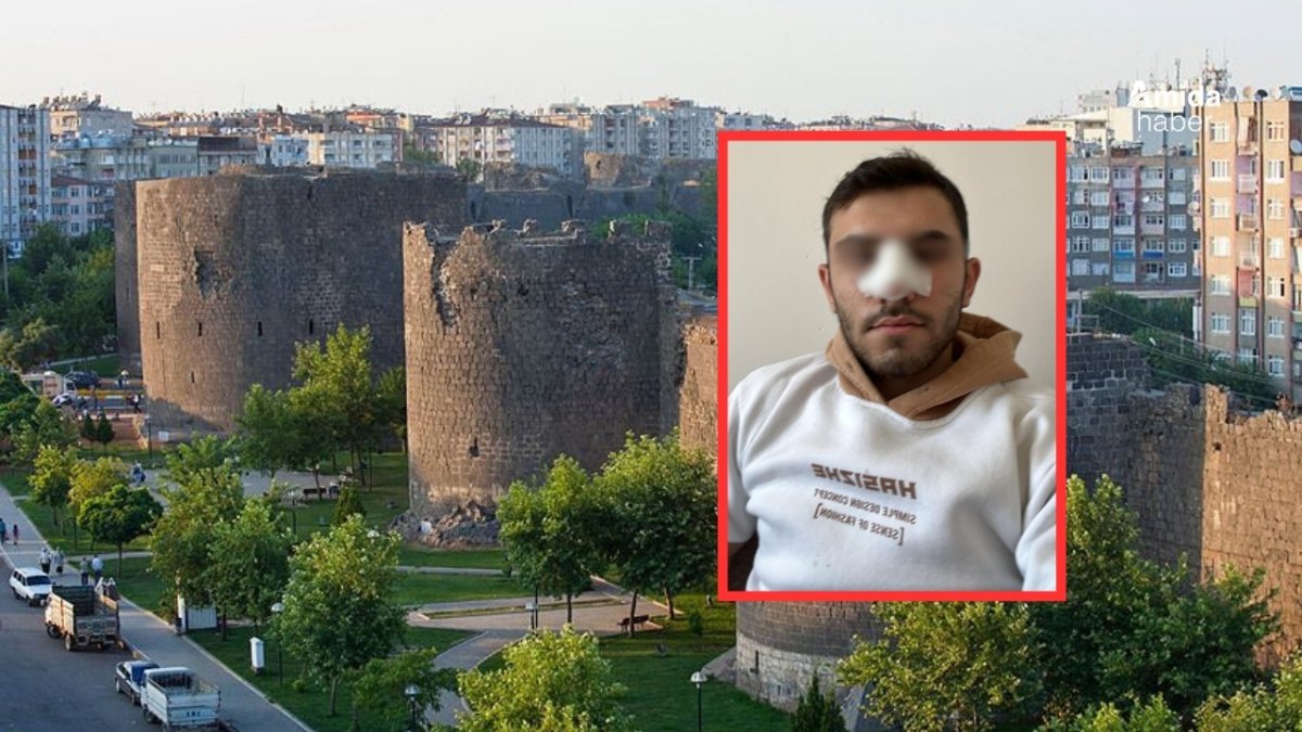 Amed de doktorî ciwanêk derb kerd: Zincîya ey şikîya
